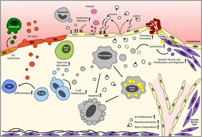 Message in a Microbottle: Modulation of Vascular Inflammation and Atherosclerosis by Extracellular Vesicles